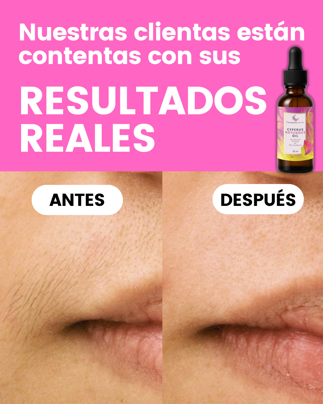 Serum natural 🌿 Reduce el crecimiento del vello corporal ¡YA NO TENDRÁS QUE DEPILARTE!✨ DESCUENTO BLACK FRIDAY