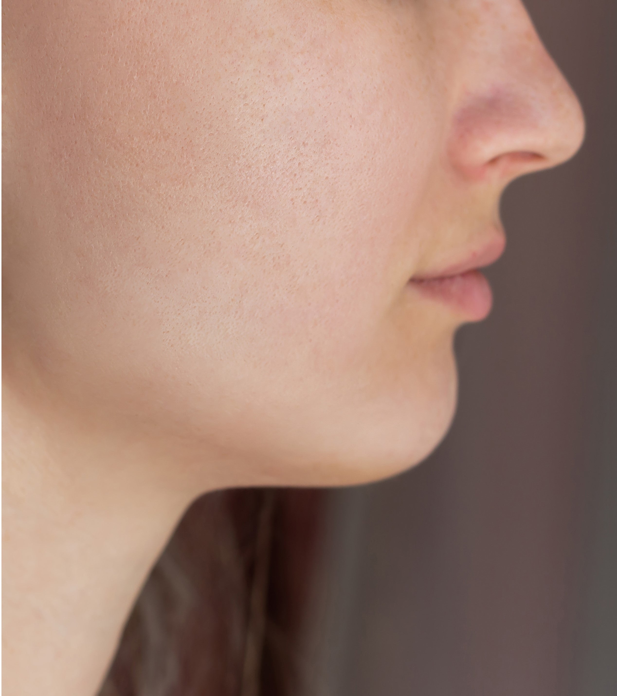 files/cropped-shot-young-womans-face-before-after-acne-treatment-face-pimples-rash-cheeks.jpg